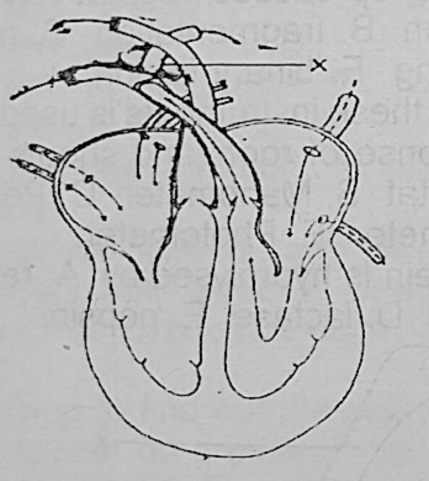 Diagram for this question
