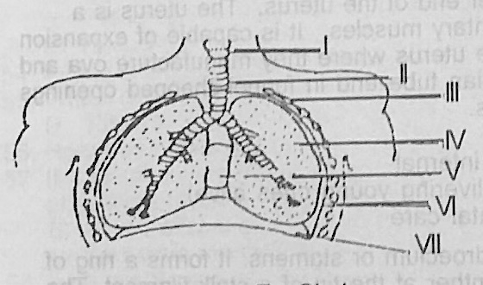 Diagram for this question